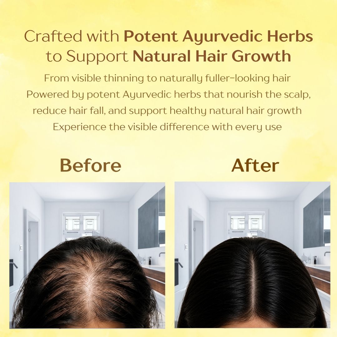 BRAHM Ayurvedic Hair Oil for Hair Growth | Hair Fall & Dandruff Control | Bhringraj, Amla, Jatamansi & 15 Herbal Ingredients | 100ml