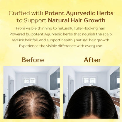 BRAHM Ayurvedic Hair Oil for Hair Growth | Hair Fall & Dandruff Control | Bhringraj, Amla, Jatamansi & 15 Herbal Ingredients | 100ml